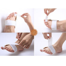 Load image into Gallery viewer, Bunion Corrector Splint Brace Hallux Valgus Toe Orthopedic